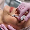 Enhance Your Look: Everyday Makeup Application Tips and Dermal Fillers in Woodland Hills